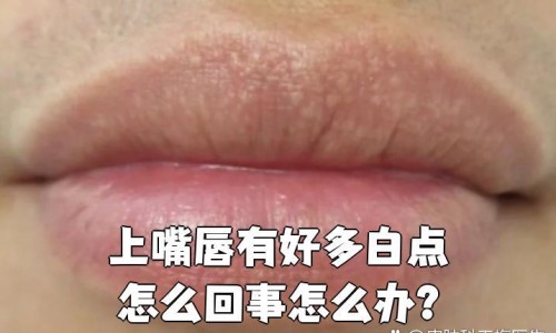 【坐月子期间感觉骨头都是松松的怎么回事】坐月子期间骨头发痒怎么回事 - 坐月子期间骨头发痒网